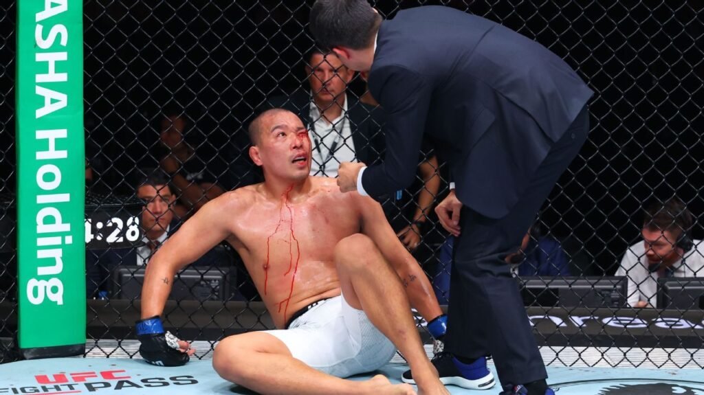 Russo acerta joelhada ilegal e deixa rival sangrando no UFC