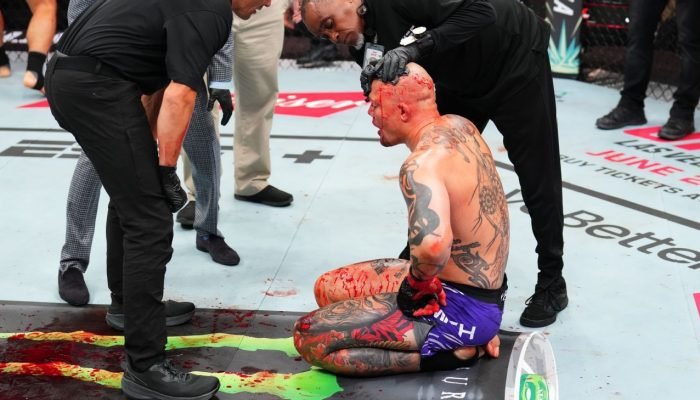 Algoz-de-brasileiros-Anthony-Smith-se-aposenta-do-UFC-com.jpeg Algoz de brasileiros, Anthony Smith se aposenta do UFC com 'cabeça aberta' e 'banho de sangue'